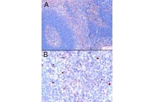 ABIN184677 (1µg/ml) staining of paraffin embedded Human Tonsil. (FOXP3 抗体  (C-Term))