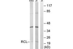 Western Blotting (WB) image for anti-Chromosome 6 Open Reading Frame 108 (C6orf108) (AA 1-50) antibody (ABIN2890227) (RCL 抗体  (AA 1-50))