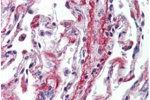 Human Lung (formalin-fixed, paraffin-embedded) stained with PODXL antibody ABIN462244 followed by biotinylated goat anti-rabbit IgG secondary antibody ABIN481713, alkaline phosphatase-streptavidin and chromogen. (PODXL 抗体  (AA 301-350))