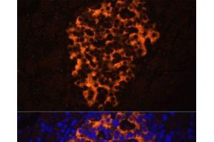 Immunofluorescence analysis of Rat pancreas using PNLIPRP2 Polyclonal Antibody at dilution of 1:100. (PNLIPRP2 抗体)