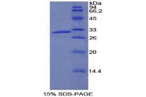 SDS-PAGE (SDS) image for Phosphatidylinositol-4-Phosphate 3-Kinase, Catalytic Subunit Type 2 beta (PIK3C2B) (AA 790-1025) protein (His tag) (ABIN1878339)