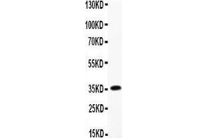 Anti-MCP3 Picoband antibody,  All lanes: Anti-MCP3 at 0. (CCL7 抗体  (AA 24-97))