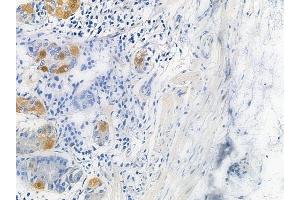 ABIN6265571 and ABIN6279871 at 1/100 staining human normal gastric tissue by IHC-P. (TIGD4 抗体  (Internal Region))