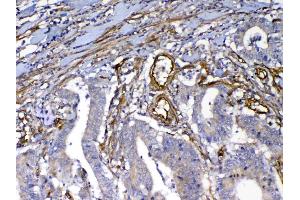 IHC analysis of VEGF Receptor 3 using anti-VEGF Receptor 3 antibody . (FLT4 抗体  (AA 25-259))