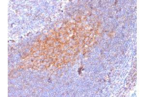 Formalin-fixed, paraffin-embedded human Lymph Node stained with CD81 Mouse Monoclonal Antibody (1. (CD81 抗体)