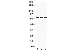 Western blot testing of human 1) HeLa, 2) MCF7 and 3) SW620 lysate wtih KEAP1 antibody.