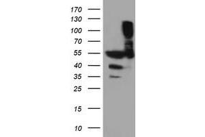 Western Blotting (WB) image for anti-Tubulin, alpha-Like 3 (TUBAL3) (AA 150-446) antibody (ABIN1490951) (TUBAL3 抗体  (AA 150-446))