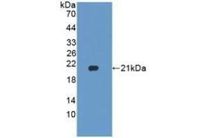 Detection of Recombinant HPA, Rat using Polyclonal Antibody to Heparanase (HPSE) (HPSE 抗体  (AA 40-188))