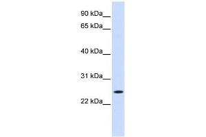 Western Blot showing NOL3 antibody used at a concentration of 1-2 ug/ml to detect its target protein. (NOL3 抗体  (Middle Region))