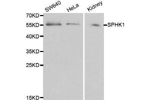 Western blot analysis of extracts of various cell lines, using SPHK1 antibody. (SPHK1 抗体  (AA 50-384))