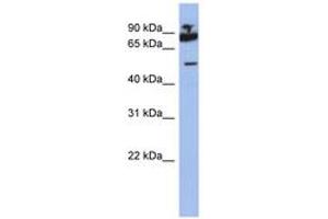 Image no. 1 for anti-IKAROS Family Zinc Finger 1 (Ikaros) (IKZF1) (AA 395-444) antibody (ABIN6742315) (IKZF1 抗体  (AA 395-444))