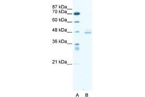 WB Suggested Anti-LDB1 Antibody Titration:  0. (LIM Domain Binding 1 Protein 抗体  (Middle Region))