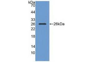 Detection of Recombinant RASA1, Human using Polyclonal Antibody to Ras GTPase Activating Protein 1 (RASA1)