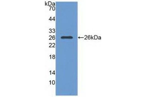 RASA1 抗体  (AA 403-596)