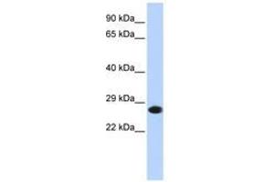 Image no. 1 for anti-Proteasome Subunit alpha 2 (PSMA2) (AA 36-85) antibody (ABIN6741386) (PSMA2 抗体  (AA 36-85))