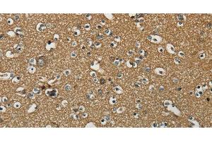 Immunohistochemistry of paraffin-embedded Human brain using NEMF Polyclonal Antibody at dilution of 1:30 (NEMF 抗体)