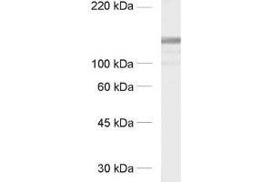 dilution: 1 : 1000, sample: crude synaptic membranes fraction of rat brain (LP1) (GRIP1 抗体  (AA 662-769))