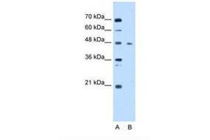 Image no. 1 for anti-Enolase 3 (Beta, Muscle) (ENO3) (AA 21-70) antibody (ABIN6738428) (ENO3 抗体  (AA 21-70))