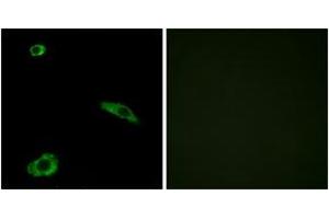 Immunofluorescence analysis of MCF7 cells, using ACTHR Antibody. (MC2R 抗体  (AA 248-297))