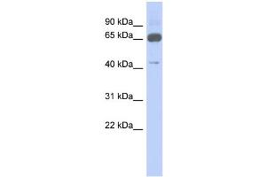 WB Suggested Anti-ZNF446 Antibody Titration:  0. (ZNF446 抗体  (N-Term))