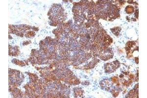 Formalin-fixed, paraffin-embedded human parathyroid stained with PTH antibody (PTH/1174). (PTH 抗体  (AA 32-115))
