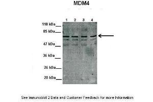 Lanes:  1. (MDM4-binding Protein 抗体  (N-Term))