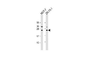 All lanes : Anti-STAG3L1 Antibody (Center) at 1:2000 dilution Lane 1: MCF-7 whole cell lysate Lane 2: ZR-75-1 whole cell lysate Lysates/proteins at 20 μg per lane. (STAG3L1 抗体  (AA 108-136))