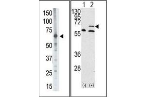 Image no. 1 for anti-Matrix Metallopeptidase 14 (Membrane-inserted) (MMP14) (N-Term) antibody (ABIN358687) (MMP14 抗体  (N-Term))