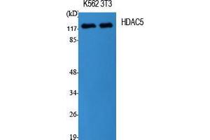Western Blot (WB) analysis of specific cells using HDAC5 Polyclonal Antibody.
