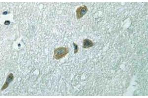 Immunohistochemistry (IHC) analyzes of ILK antibody in paraffin-embedded human brain tissue. (ILK 抗体)