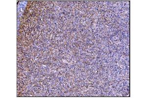 IHC analysis of Prolyl Endopeptidase/PREP using anti-Prolyl Endopeptidase/PREP antibody (ABIN7599118). (PREP 抗体  (AA 1-227))