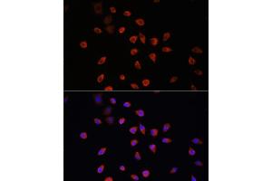 Immunofluorescence analysis of L929 cells using IFT88 antibody (ABIN6131798, ABIN6142226, ABIN6142227 and ABIN6216899) at dilution of 1:100. (IFT88 抗体  (AA 534-833))