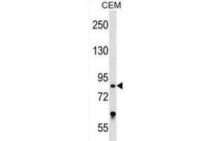 Western Blotting (WB) image for anti-Transcription Factor 25 (Basic Helix-Loop-Helix) (TCF25) antibody (ABIN2999343) (TCF25 抗体)