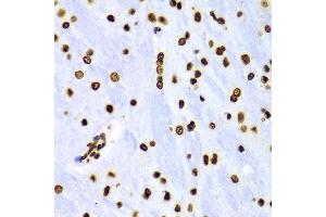 Immunohistochemistry (IHC) image for anti-Histone 3 (H3) (H3K4me) antibody (ABIN3023251)