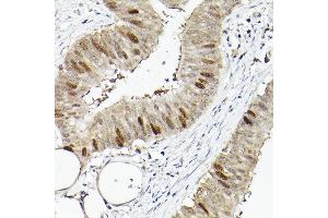 Immunohistochemistry (IHC) image for anti-Rac GTPase Activating Protein 1 (RACGAP1) (AA 353-632) antibody (ABIN6146621)
