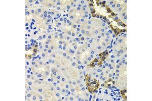 Immunohistochemistry of paraffin-embedded mouse kidney using CALB2 antibody (ABIN6003539) at dilution of 1/100 (40x lens). (Calretinin 抗体)