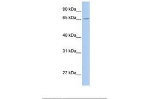 Image no. 1 for anti-Fragile X Mental Retardation, Autosomal Homolog 2 (FXR2) (AA 434-483) antibody (ABIN6737936) (FXR2 抗体  (AA 434-483))