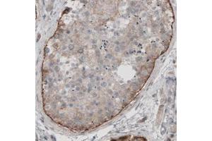Immunohistochemical staining (Formalin-fixed paraffin-embedded sections) of human testis with LAMA1 monoclonal antibody, clone CL3087  shows moderate immunoreactivity in basement membrane of seminiferous tubules. (Laminin alpha 1 抗体)