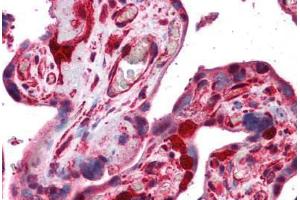 Human Placenta: Formalin-Fixed, Paraffin-Embedded (FFPE) (Stathmin 1 抗体  (AA 85-119))