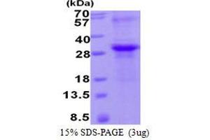 Image no. 1 for Metalloproteinase Inhibitor 2 (TIMP2) protein (His tag) (ABIN1098377) (TIMP2 Protein (His tag))