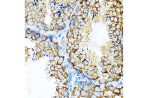 Immunohistochemistry of paraffin-embedded mouse testis using STIP1 Rabbit mAb (ABIN1512566, ABIN3020619, ABIN3020620 and ABIN7101303) at dilution of 1:100 (40x lens). (STIP1 抗体)