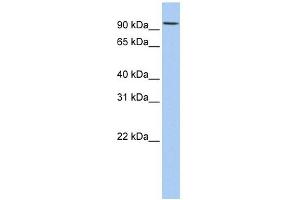 RNF19A antibody used at 1 ug/ml to detect target protein. (RNF19A 抗体  (N-Term))
