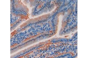 Used in DAB staining on fromalin fixed paraffin- embedded Kidney tissue (Angiopoietin 4 抗体  (AA 272-489))