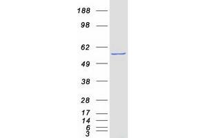 Validation with Western Blot