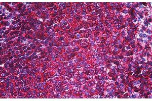 Human Spleen: Formalin-Fixed, Paraffin-Embedded (FFPE) (CD44 抗体)