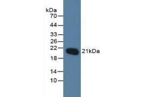 Detection of MGMT in Human Jurkat Cells using Polyclonal Antibody to O-6-Methylguanine DNA Methyltransferase (MGMT) (MGMT 抗体  (AA 1-207))