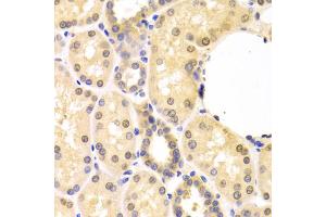 Immunohistochemistry of paraffin-embedded human kidney using SMAD1 antibody. (SMAD1 抗体)