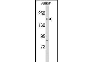 RP1 Antibody (N-term) (ABIN1539273 and ABIN2848774) western blot analysis in Jurkat cell line lysates (35 μg/lane). (RPAP1 抗体  (N-Term))