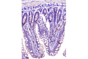 IHC analysis of RASAL1 using anti-RASAL1 antibody (ABIN6719367).