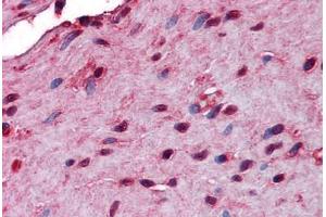 anti-Stress-Induced-phosphoprotein 1 (STIP1) (AA 1-544) antibody